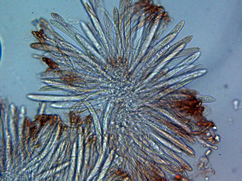 Coccomyces dentatus 10 - Ascos x 400 1